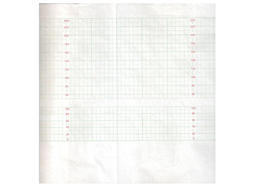 Foetal monitors, cardiotocographs, PAPER for 29520