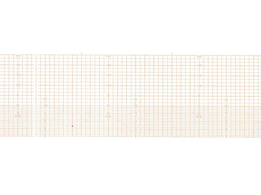Foetal monitors, cardiotocographs, Z-FOLD PAPER 112x100 mm for 29550 - 150 sheet