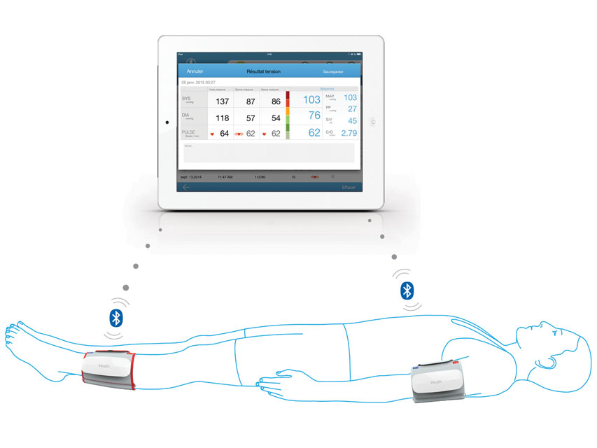 Elektrokardiogrāfi 1-3 kan, Bezvadu monitoringa sistēma Ihealth cardio lab