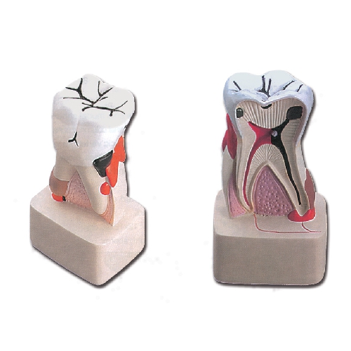 ZOBU PATOLOĢIJA - 4:1