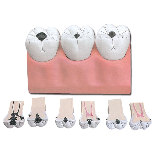 ZOBU KARIES - 7 DAĻAS - 4X