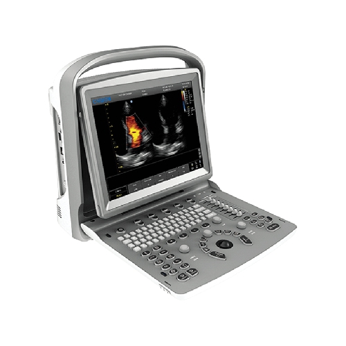 P10 CHISON ECO6 KRĀSU USG - 2 ZONDES SAVIENOTĀJI